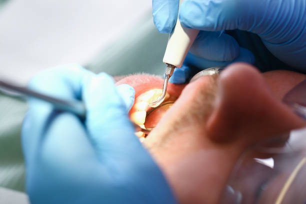 Professional Emergency Dentist in IN